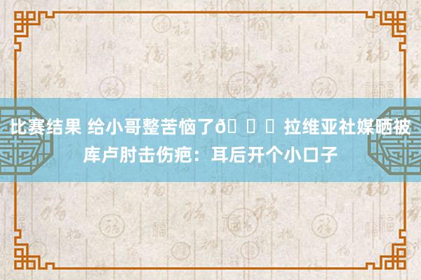 比赛结果 给小哥整苦恼了😅拉维亚社媒晒被库卢肘击伤疤：耳后开个小口子